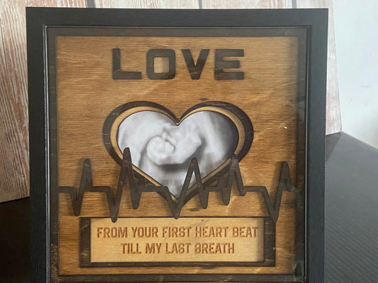 Love Shadow Box